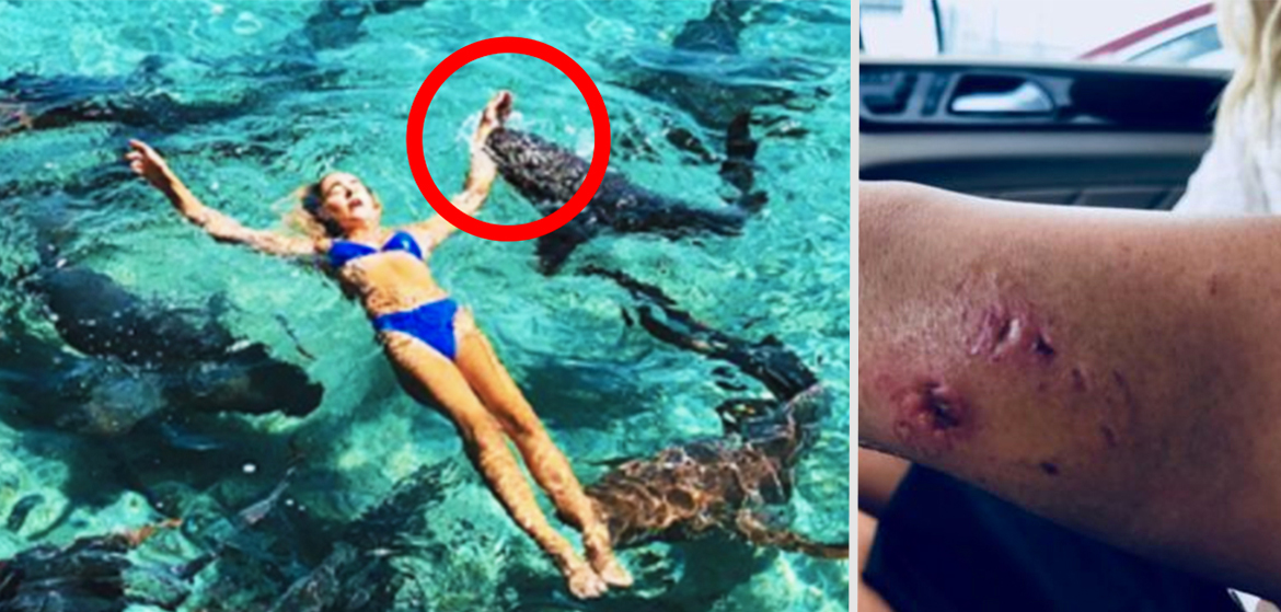 Une star dinstagram mordue par un requin lors dune séance photo